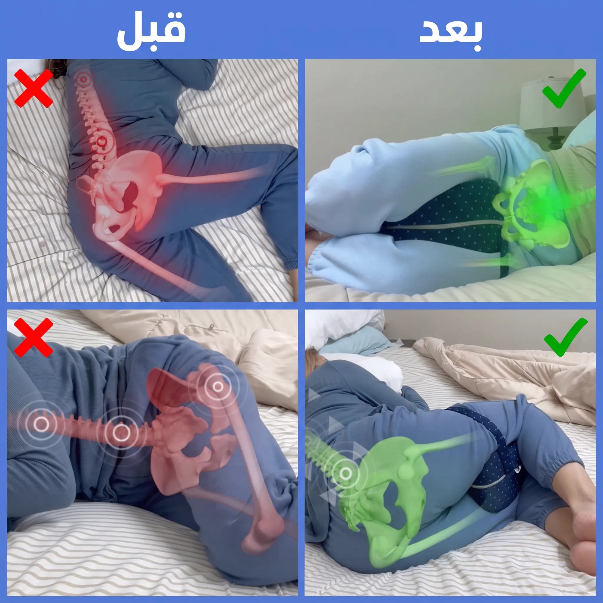 AlignMate™